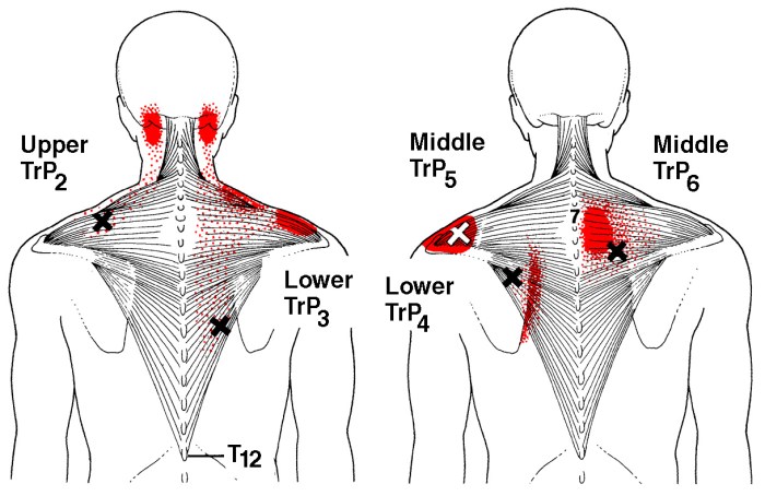 Bp2pt btn